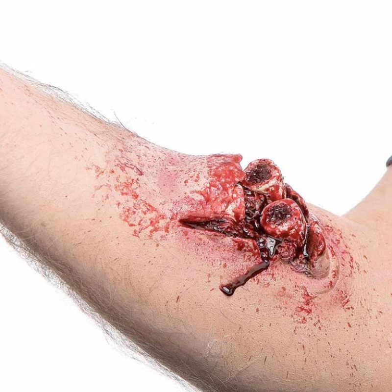 Special F/X Compound Fracture