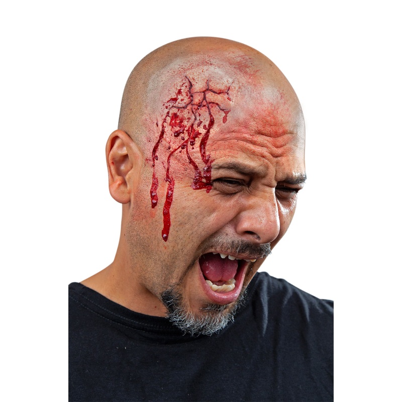 Cracked Prosthetic Standard