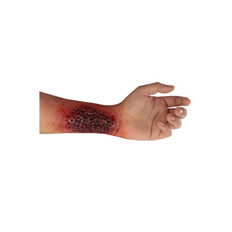 Trypophobia Prosthetic Standard