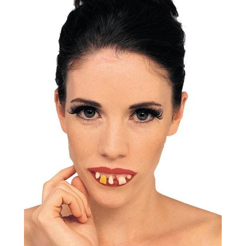 Rotting teeth dentition