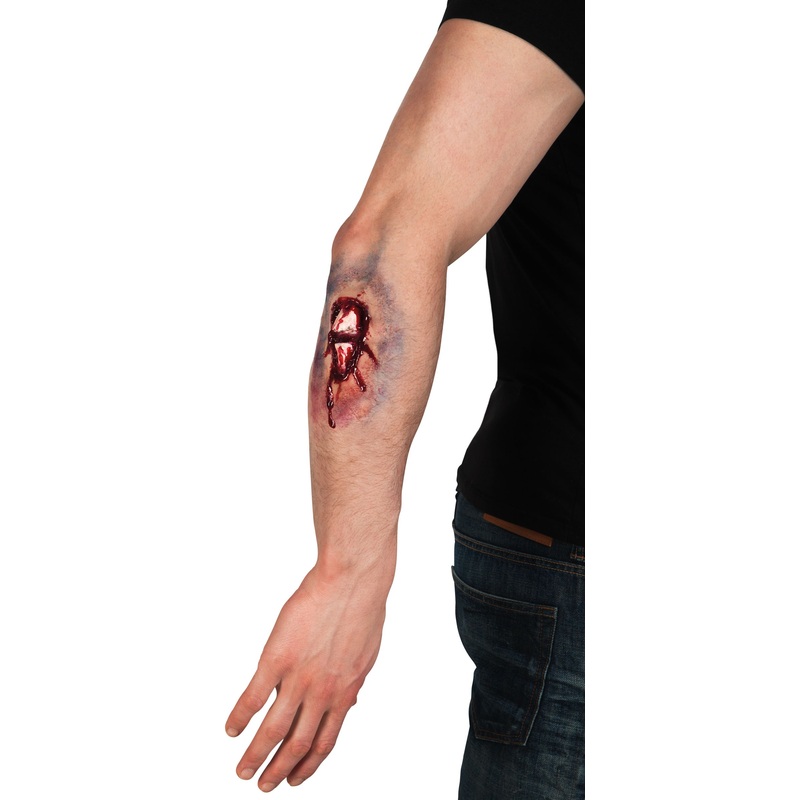 Broken arm latex application
